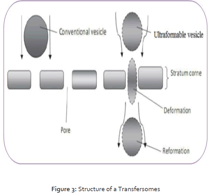 Pharmaceutics-Nanotechnology-Structure-Transfersomes