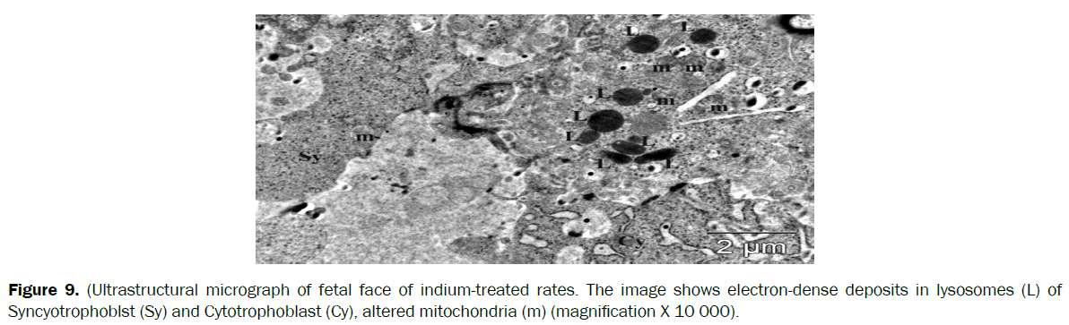 biology-ultrastructural-micrograph-indium
