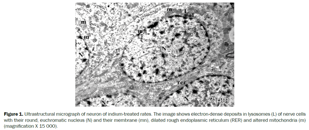 biology-ultrastructural-micrograph-neuron