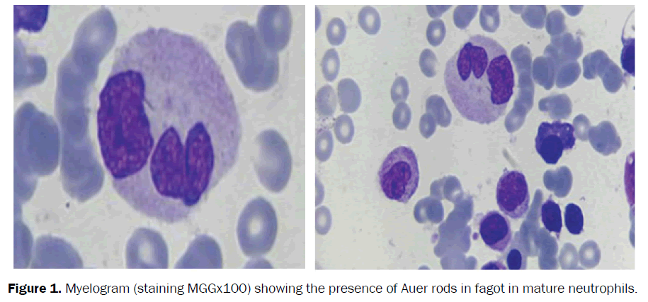 clinical-and-medical-case-studies-mature-neutrophils