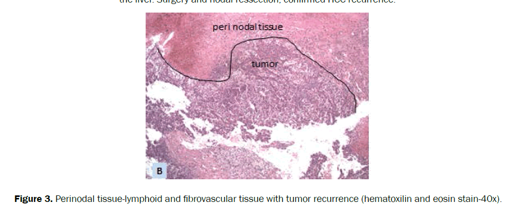 clinical-medical-fibrovascular-tissue