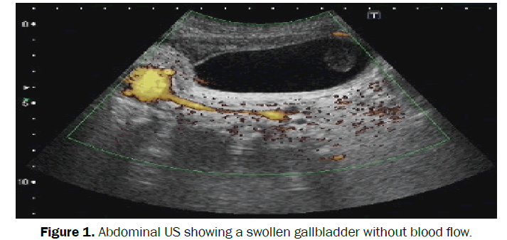 clinical-medical-swollen-gallbladder