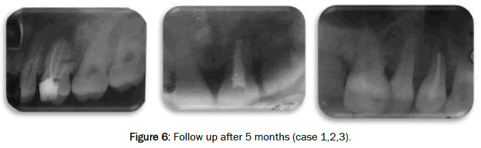 dental-sciences-Follow-after-months