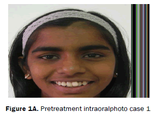 dental-sciences-Intra-Oral-Pretreatment-intraoralphoto-case