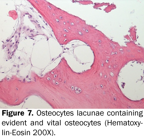 dental-sciences-Osteocytes-lacunae-evident