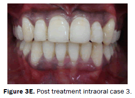 dental-sciences-Post-treatment-intraoral-case