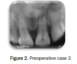 dental-sciences-Preoperative-case-2