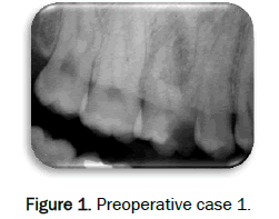 dental-sciences-Preoperative-case