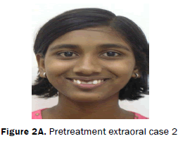 dental-sciences-Pretreatment-extraoral-case