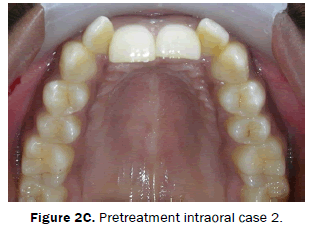 dental-sciences-Pretreatment-intraoral-case