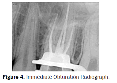 dental-sciences-Radiograph