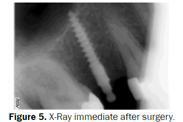 dental-sciences-X-Ray