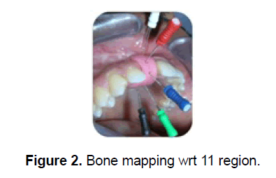 dental-sciences-bone-mapping
