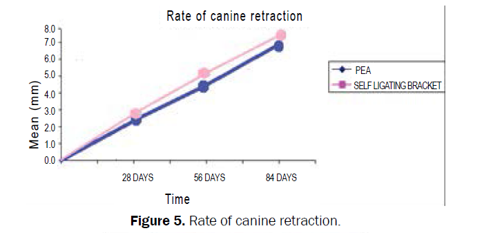 dental-sciences-canine-retraction