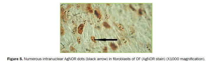 dental-sciences-fibroblasts