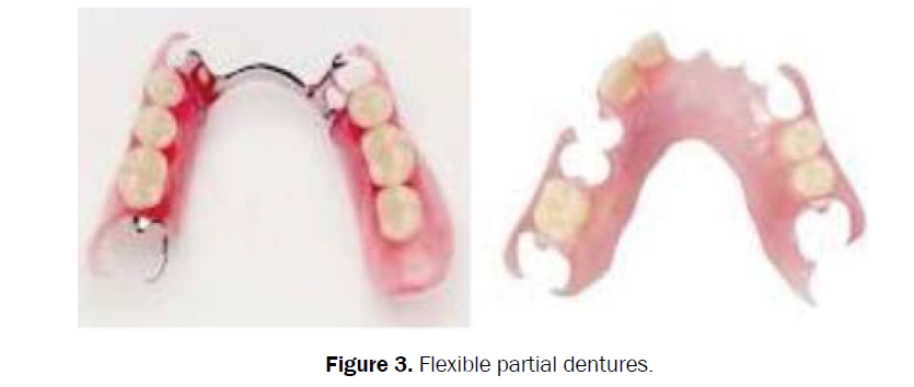 dental-sciences-flexible-partial-dentures