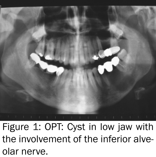 dental-sciences-inferior-alveolar-nerve