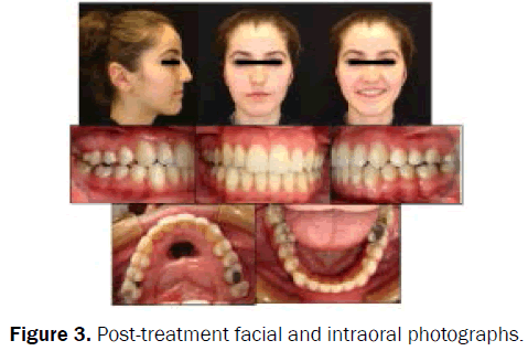 dental-sciences-intraoral