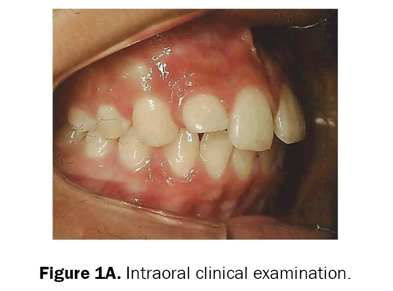 dental-sciences-intraoral-clinical-examination
