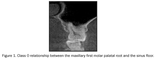 dental-sciences-maxillary-first-molar