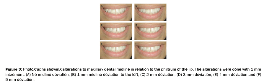 dental-sciences-midline-deviation