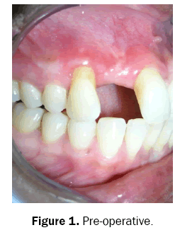 dental-sciences-operative