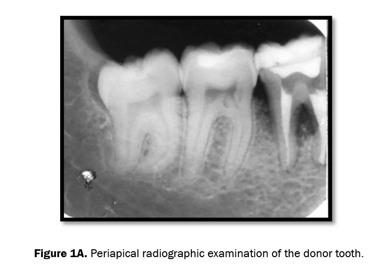 dental-sciences-periapical-radiographic