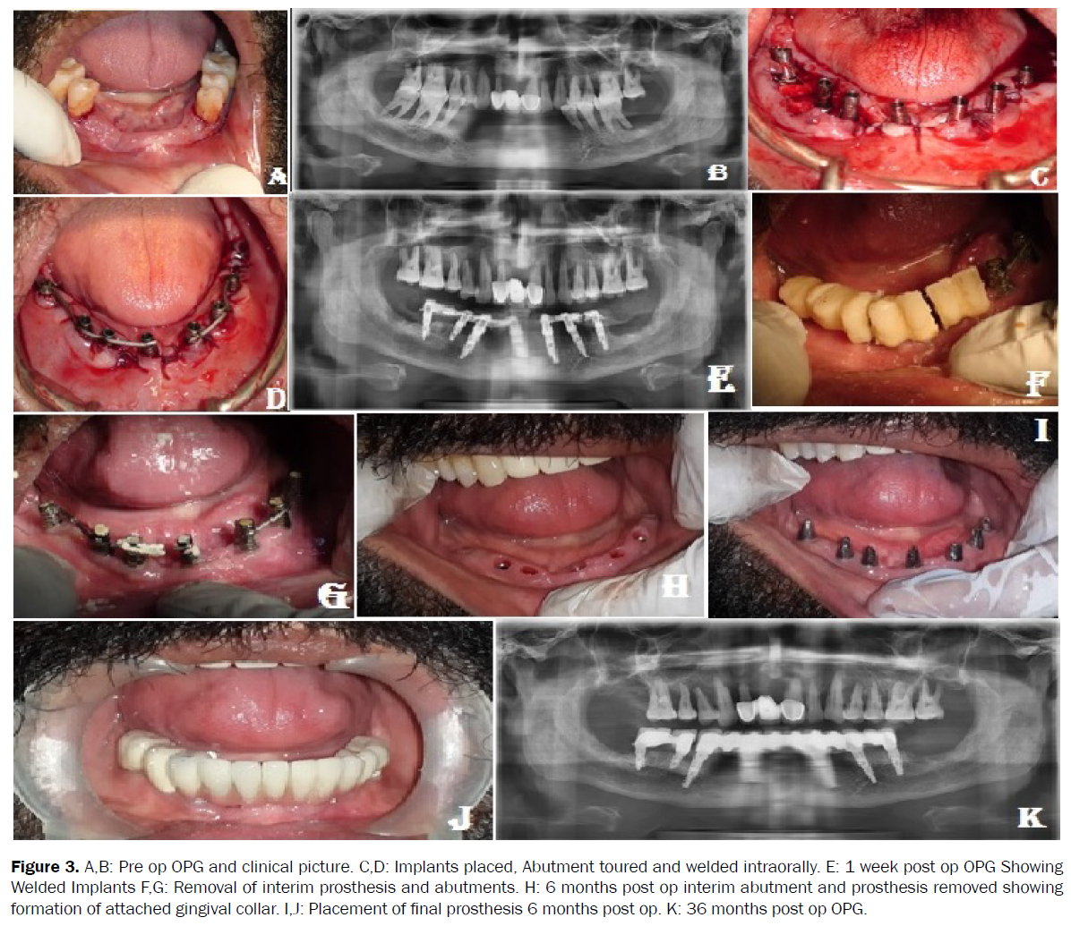 dental-sciences-pre-op-opg-clinical-picture