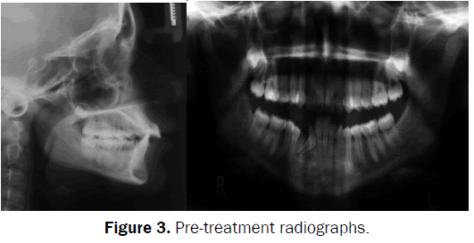 dental-sciences-radiographs