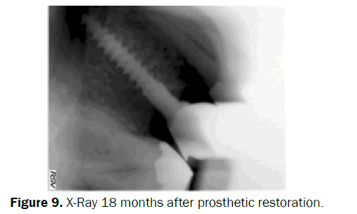 dental-sciences-restoration