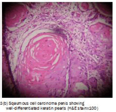 medical-and-health-sciences-Squamous-cell