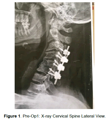 neuroscience-Spine-Lateral-View