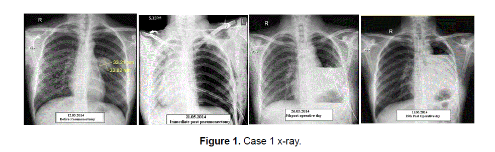 nursing-health-sciences-x-ray
