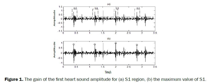 pure-applied-physics-gain-first-heart-sound-amplitude