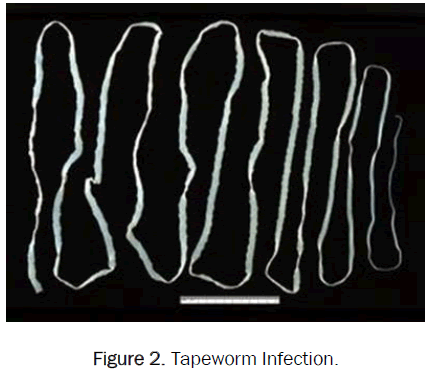 zoological-sciences-Tapeworm-Infection