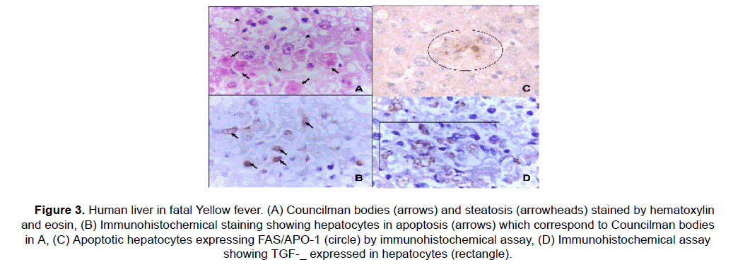 medical-health-sciences-steatosis