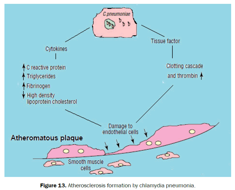 nursing-health-sciences-atherosclerosis-formation