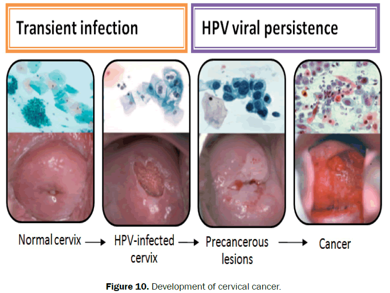 nursing-health-sciences-cervical-cancer