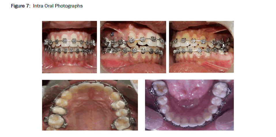 Dental-Sciences-Intra