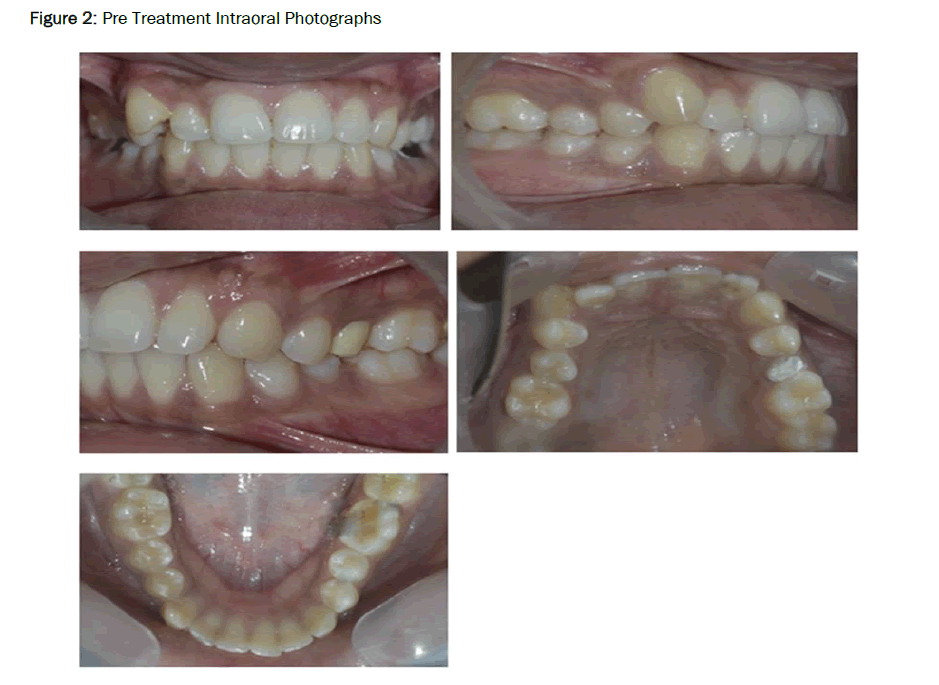 Dental-Sciences-Intraoral