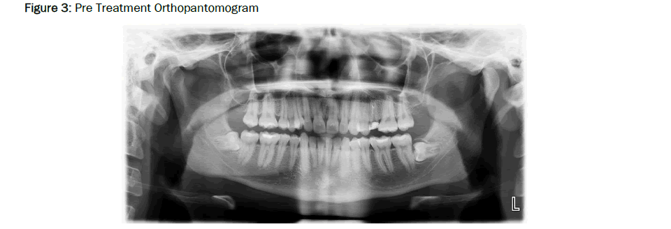 Dental-Sciences-Orthopantomogram