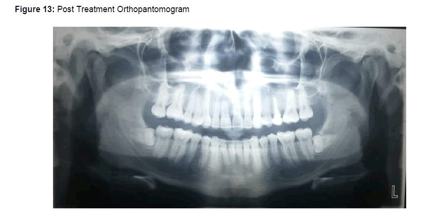Dental-Sciences-Orthopantomogram