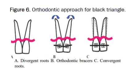 JDS-approach