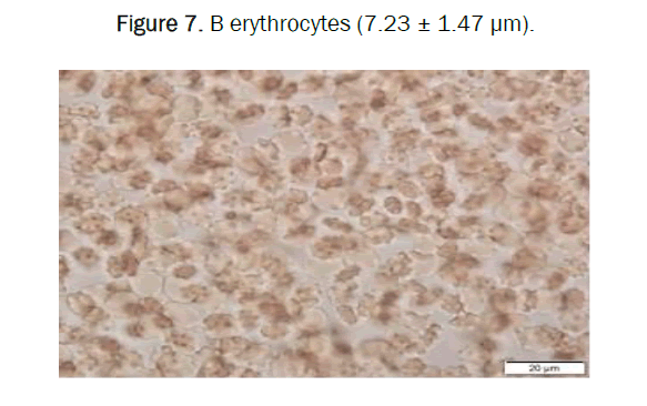 biology-B-erythrocyte