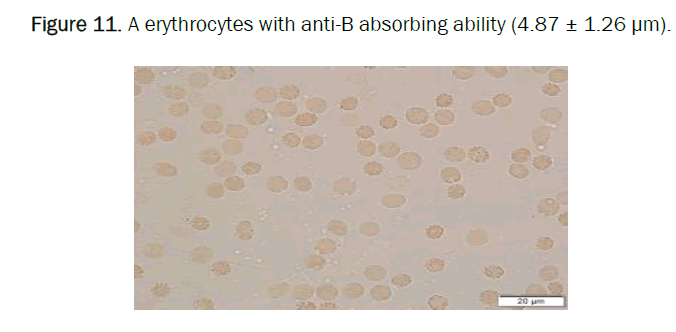 biology-rythrocy