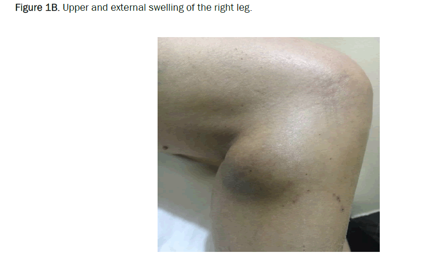 biology-swelling
