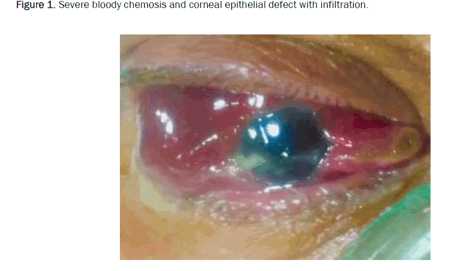 medical-case-corneal