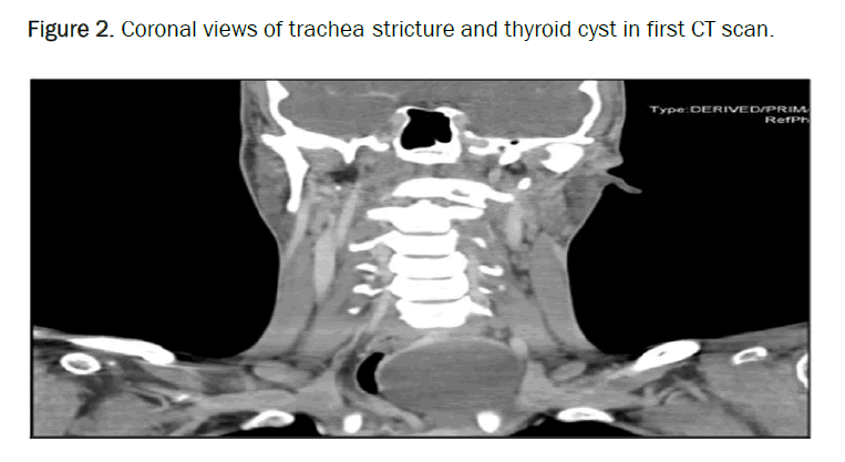 medical-case-cyst