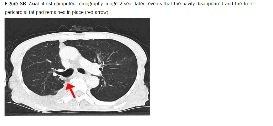 medical-case-disappeared