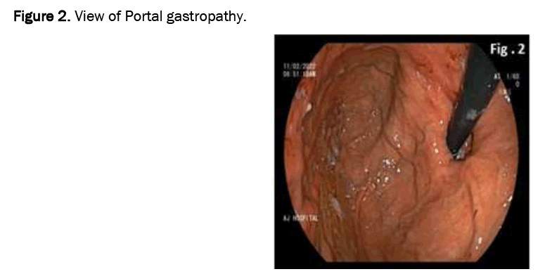medical-case-gastropathy